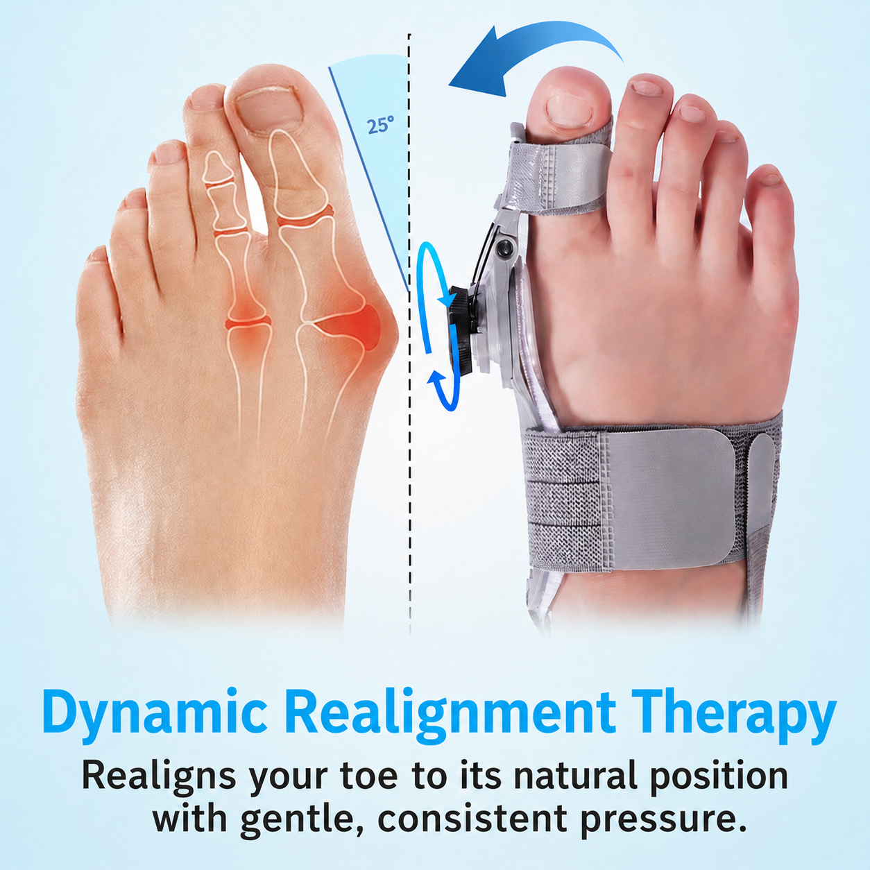 Orthio™ Bunion Fix