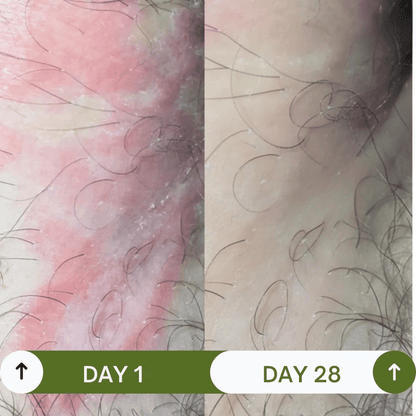 OXIE® Anti-Fungal Soap