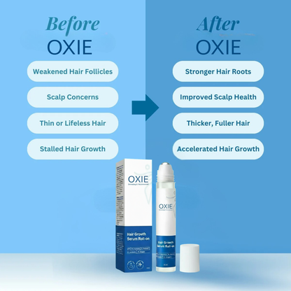 OXIE Advanced Natural Hair ReGrowth Serum