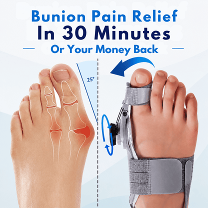 Orthio™ Bunion Fix